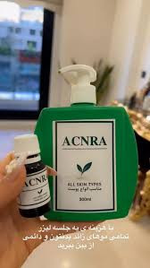 موبر دائمی آکنرا